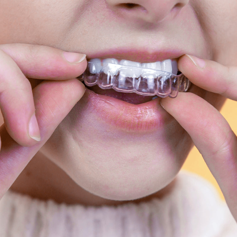 Straighten Your Smile with Custom Orthodontic Aligners – Discreet & Effective!