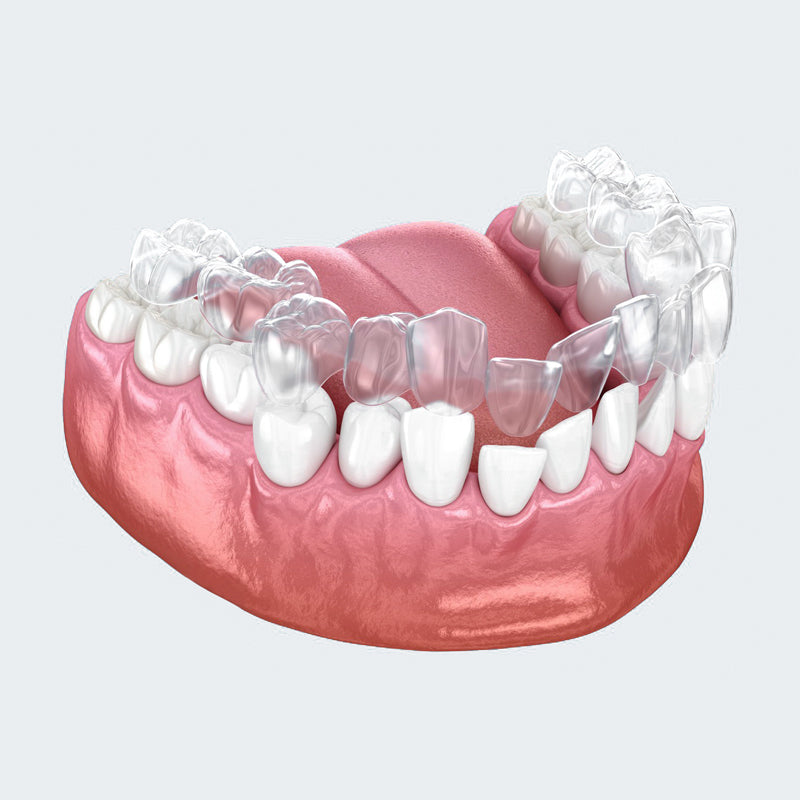 Straighten Your Smile with Custom Orthodontic Aligners – Discreet & Effective!